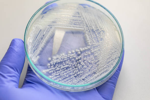 istock Yeast in petri dish, Microbiology for education in laboratories. 1273829108