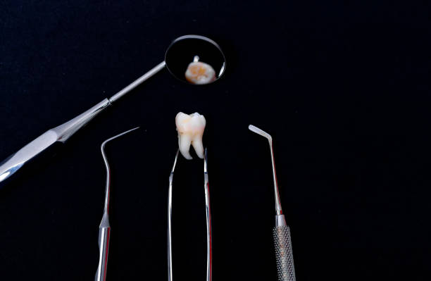 istock Dental instruments around ceramic tooth model. Black background. Art photo. 1273851173