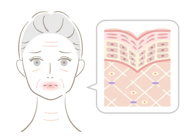 Vector illustration of woman and winkle skin layer. Beauty and skin care concept.