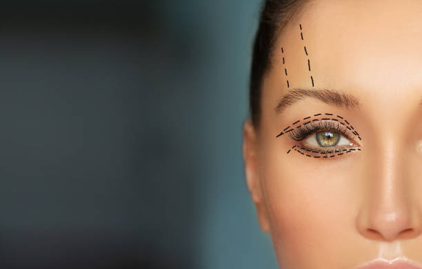 Lower and upper Blepharoplasty.Marking the face.Perforation lines on females face, plastic surgery concept. Lower and upper Blepharoplasty.Marking the face.Perforation lines on females face, plastic surgery concept. lid stock pictures, royalty-free photos & images