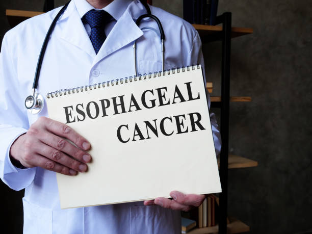 Esophageal cancer concept. Doctor holds medical papers. Esophageal cancer concept. A Doctor holds medical papers. pyloric sphincter stock pictures, royalty-free photos & images