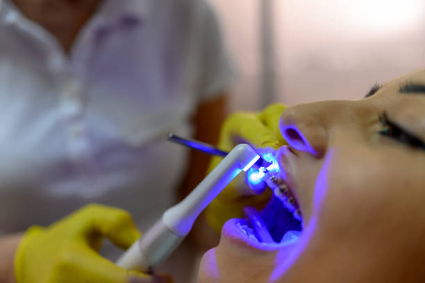 Dentistry dentist working teeth whitening dental medical process
