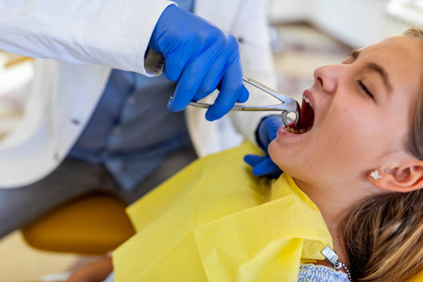 istock Dentist extracted the tooth Girl with pliers 1275788724