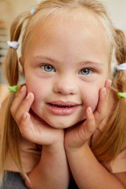 istock Cute Girl with Down Syndrome Close Up 1275856798