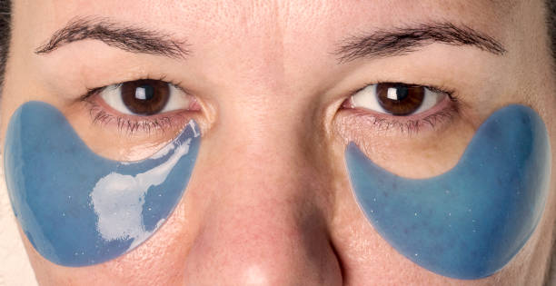 istock woman's face close up during Spa treatment with blue patches under her eyes 1276370198