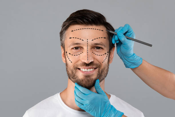 surgeon hands making marks on smiling man face - rebellion aging process facial mask beauty treatment imagens e fotografias de stock