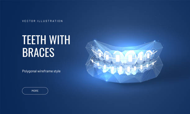 illustrations, cliparts, dessins animés et icônes de illustration vectorielle d’accolades dentaires dans le modèle polygonal futuriste. traitement orthodontique dentaire pour l’amélioration de morsure - human teeth dental hygiene dentist office human mouth