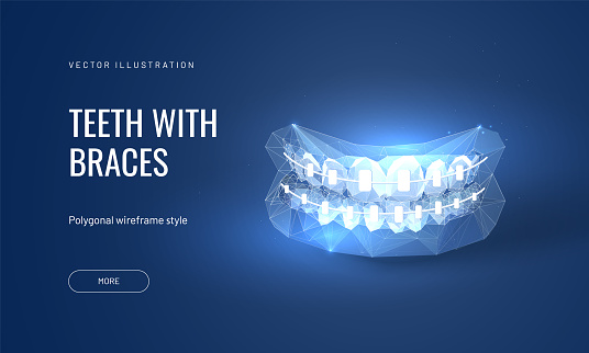 Dental braces vector illustration in futuristic polygonal style. Dental orthodontic treatment for bite improvement
