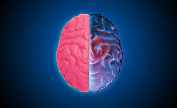 Photo of 3D rendering brain top view pink on left and multi color purple on right