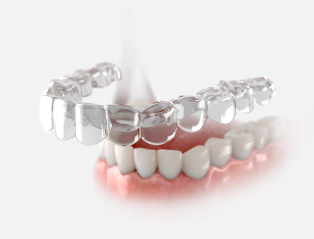 Transparent retainer Transparent retainer fixed on lower jow. dental aligner photos stock pictures, royalty-free photos & images