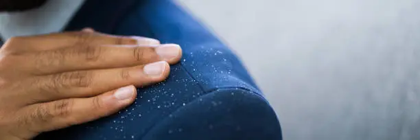 African Man Brushing Dandruff From Dirty Suit
