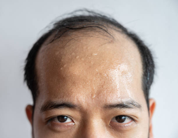 Closed portrait of Asian man forehead with sweating on his forehead cause of hot weather or etc. Sweat is actually the body's built-in cooling system when your body temperature rises. sweat stock pictures, royalty-free photos & images