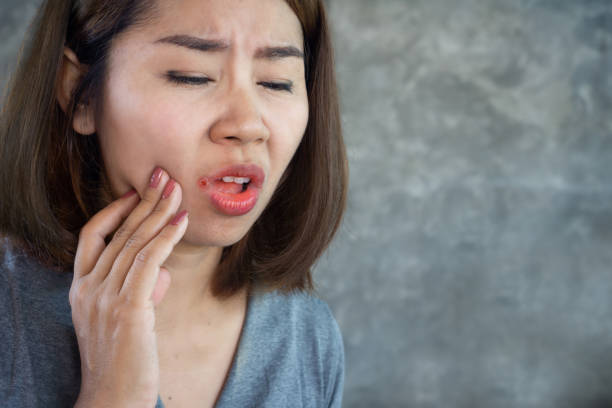asiatische frau mit problem mit mundkrankheit trockene haut auf der ecke der lippen oder angular cheilitis - menschlicher mund fotos stock-fotos und bilder