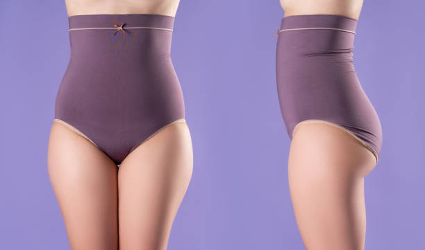 тело женщины до и после потери веса, толстая женщина в корректирующих трусиках на фиолетовом фоне - overweight tummy tuck abdomen body стоковые фото и изображения