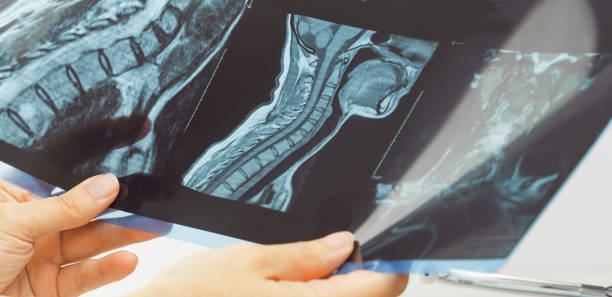 肩の状態でx線医療画像を指す女性医師 - human spine mri scan x ray doctor ストックフォトと画像