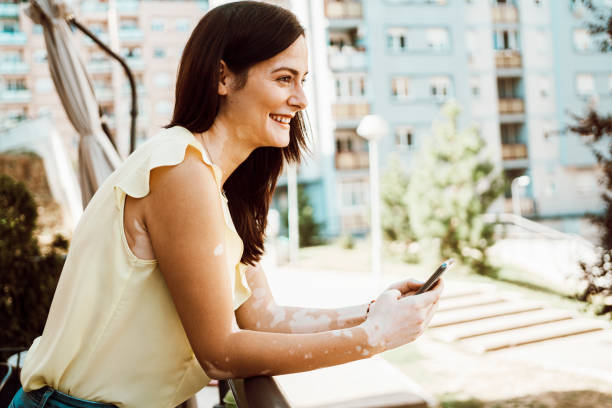 istock Beautiful young girl with skin problems using phone, enjoy in life 1277092209