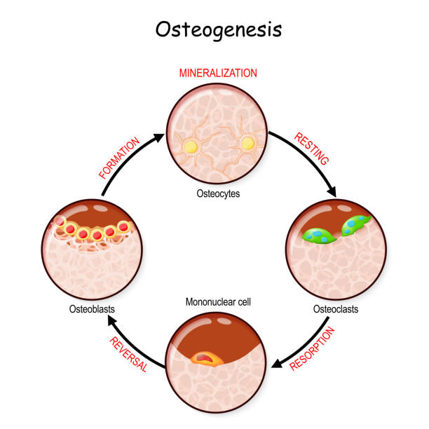 Bone Remodeling Stock Illustration - Download Image Now - iStock Bone Remodeling Stock Illustration - Download Image Now - iStock