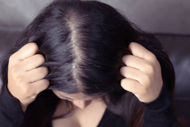 istock A woman has hair problems, she has hair loss. 1277151906