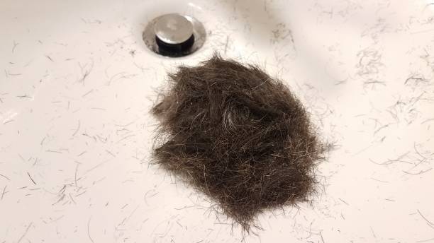 istock cut brown hair with dandruff in white bathroom sink 1277478997