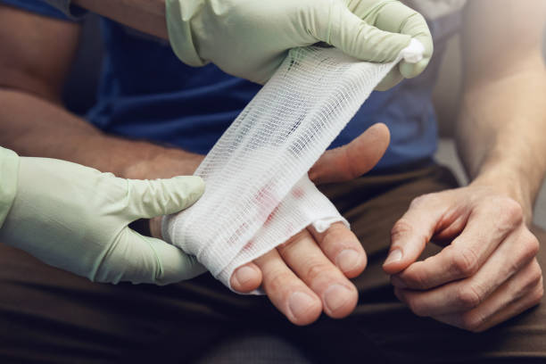 primeros auxilios - médico traumatólogo vendando la mano lesionada paciente - bandage fotografías e imágenes de stock