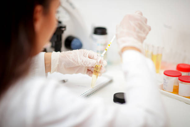 istock Wearing gloves and checking urine pH with reagent strip 1277576001