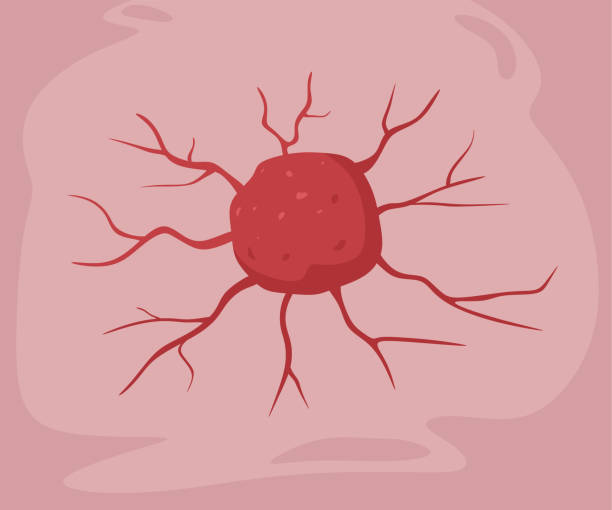 illustrazioni stock, clip art, cartoni animati e icone di tendenza di illustrazione del calcio tumorale - tumore