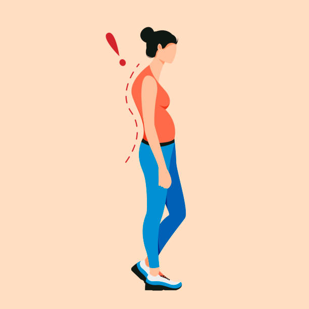 Osteoporosis flat cartoon illustration. Curve posture, back pain, spine injury. Rachiocampsis. bad posture stock illustrations
