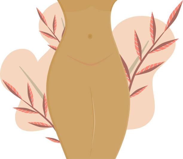 ilustrações de stock, clip art, desenhos animados e ícones de stomach with a healed scar after cesarean section. in the background, leaves in soft colors. vector illustration in flat cartoon style. motherhood and childbirth through surgery.. - cesarean
