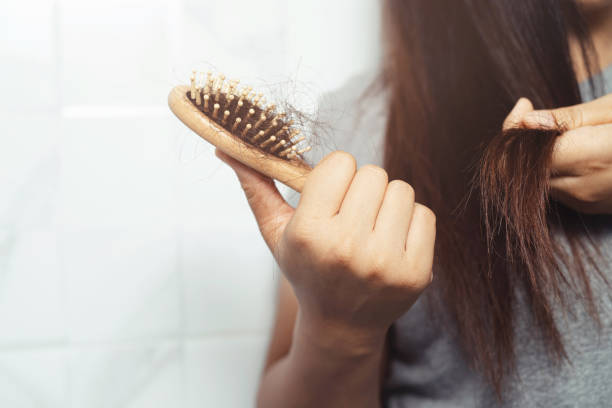 istock A woman has a problem with her hair loss. 1278048638