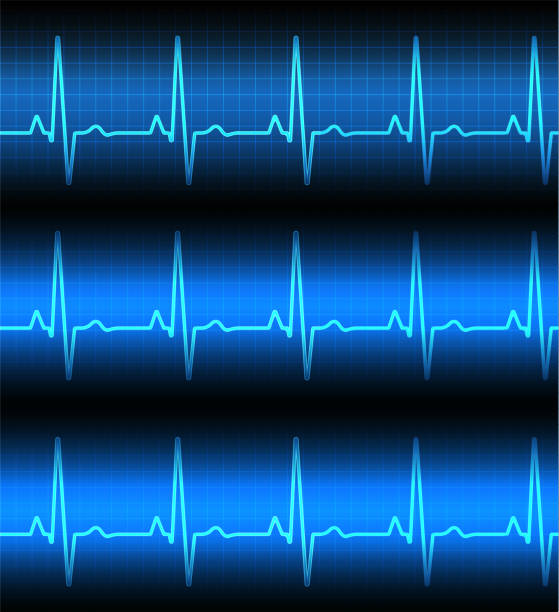 istock Heart rate graph. Heart beat. Ekg icon wave. Turquoise color. 1278109792