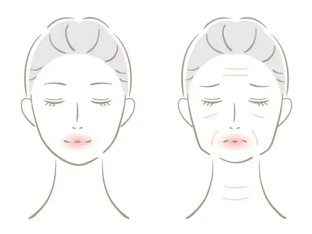 Vector illustration of winkle and young woman face. Before after illustration. Beauty skin care concept