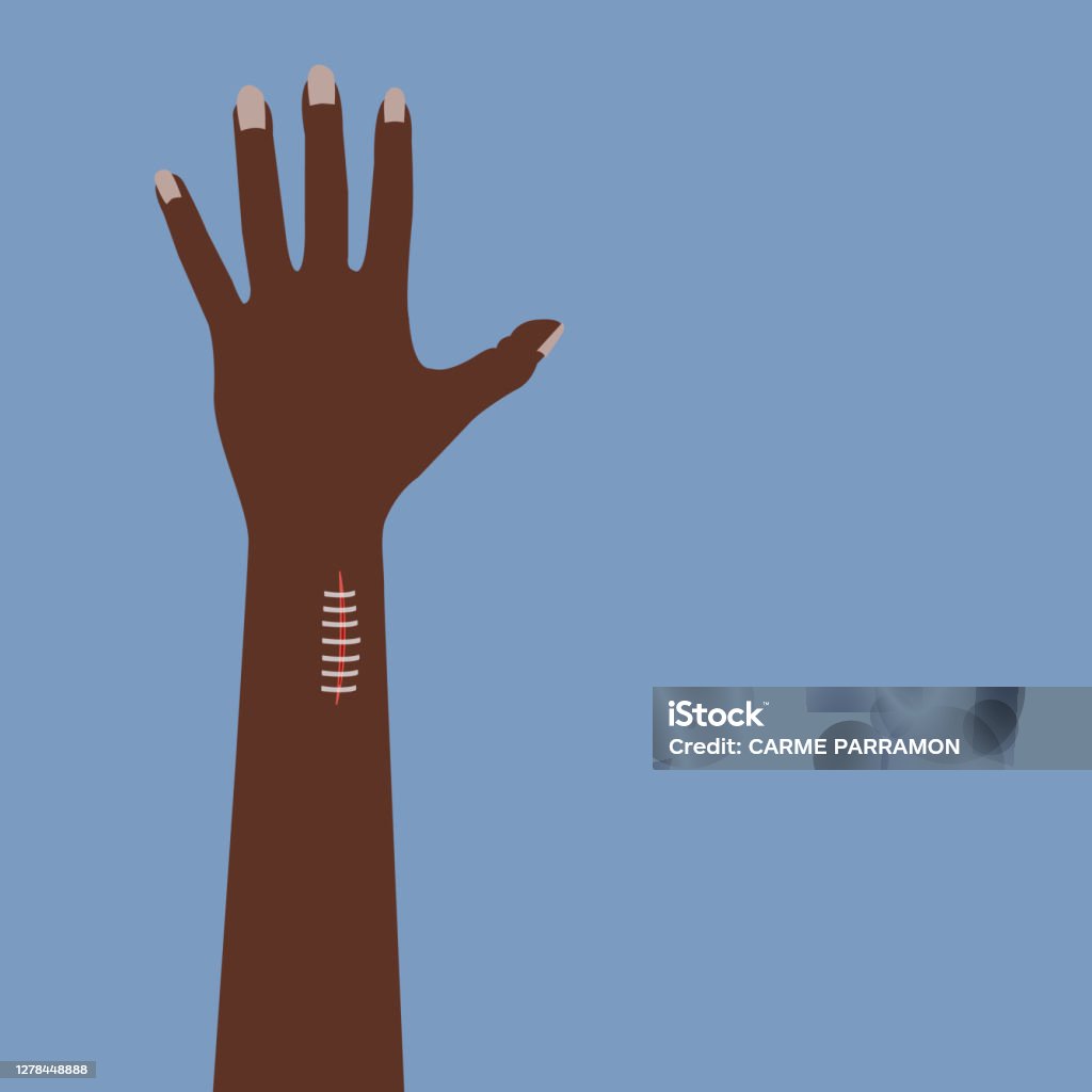 Chữa Lành Vết Cắt Sâu Trên Cánh Tay Bằng Băng Chữa Lành Vết Thương ...