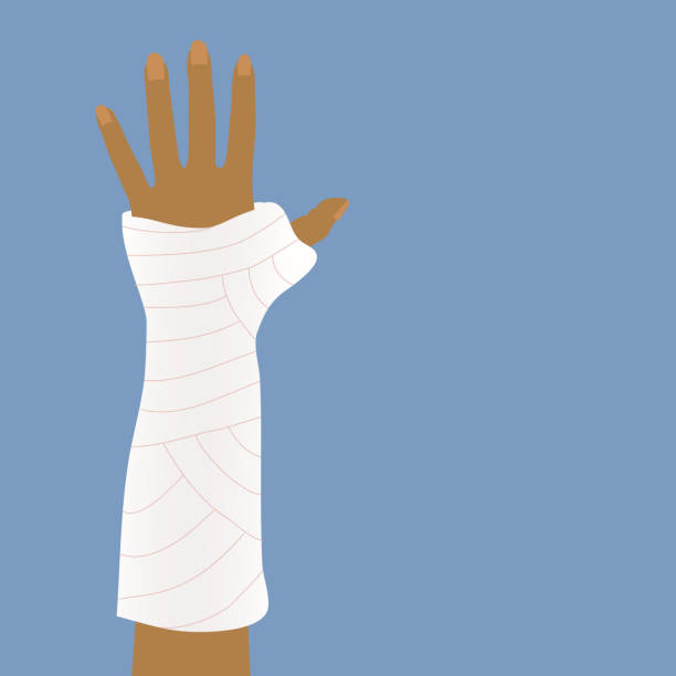 Bandages or cast for broken arms. Holding arm. Injury. The bone is broken. Medicine. orthopedic cast stock illustrations