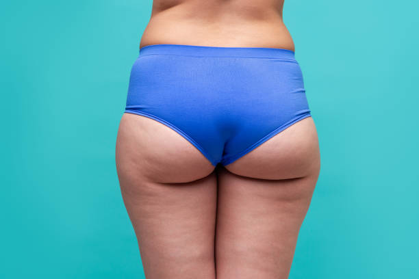 fett höfter och skinkor, fetma kvinnlig kropp på blå bakgrund - kvinna stor rumpa bildbanksfoton och bilder