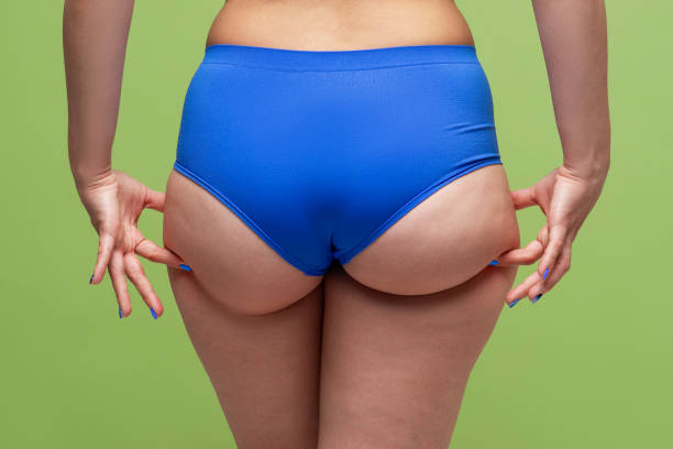 feta kvinnliga höfter och skinkor, celluliter på människokroppen på grön bakgrund - kvinna stor rumpa bildbanksfoton och bilder
