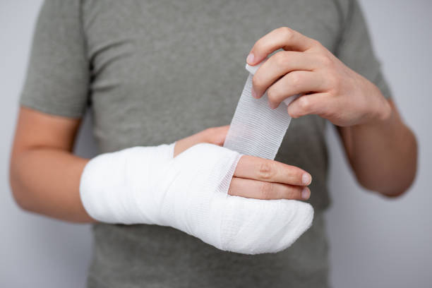 fracture et concept de premiers soins - gros plan de l’homme bandant sa main après l’accident - physical injury bandage wound cast photos et images de collection