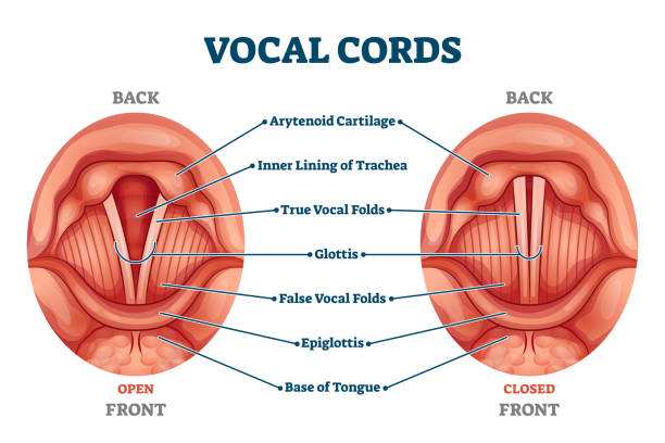 Favor Retocar Empeorando Ilustración de Cuerdas Vocales Etiquetadas Como Estructura Anatómica Y  Médica Y Esquema De Ubicación y más Vectores Libres de Derechos de Anatomía  - iStock