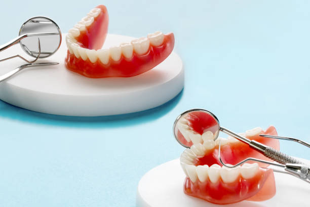 istock Teeth model showing an implant crown bridge model. 1278523076