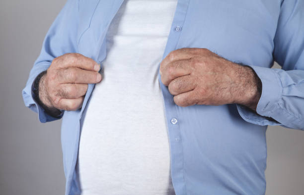 istock Fat man fastening buttons on shirt. 1278734609