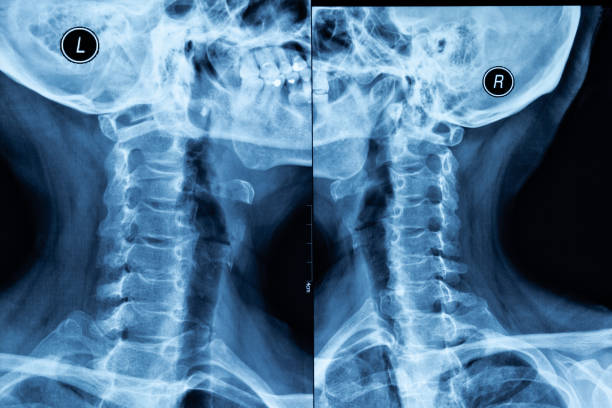 Human Head and Neck X-ray Film