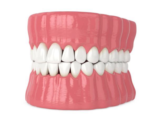 istock 3d render of human jaw with black triangles 1278802693