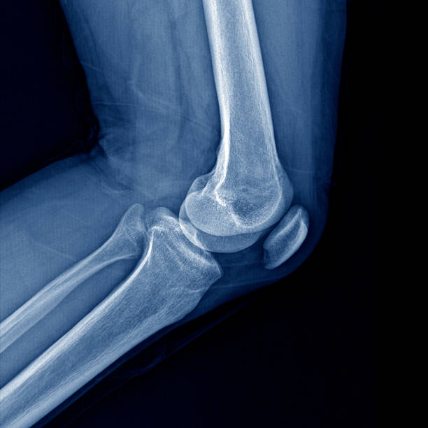 istock Disjointed and painful 1278840258