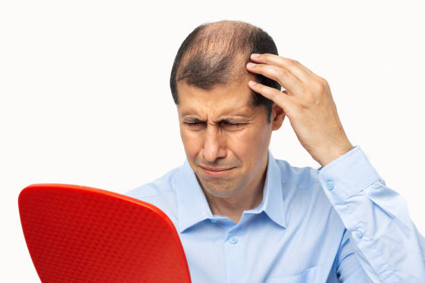 sadness man with alopecia