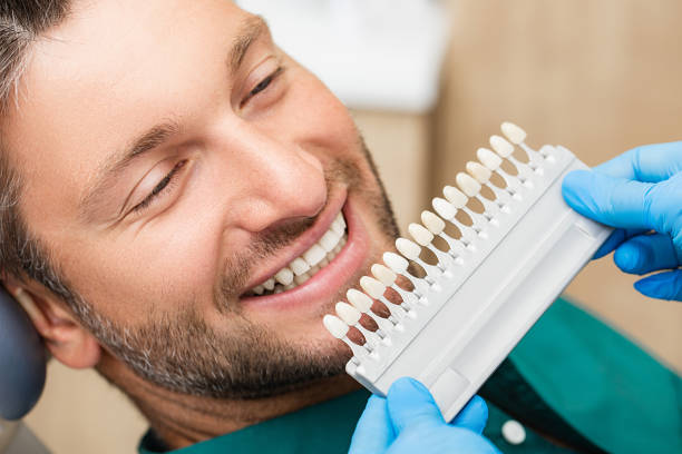 стоматолог использует палитру образца цвета зуба, чтобы определить оттенок мужских зубов пациента. стоматолог использует цвет зубов, чтоб� - human teeth whitening dentist smiling стоковые фото и изображения