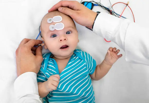 Photo of Newborn hearing screening and diagnosis at the hospital. Baby having hearing screening with special electrodes on his head and ear