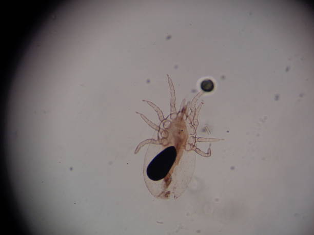 Microscope view of an itch mite.