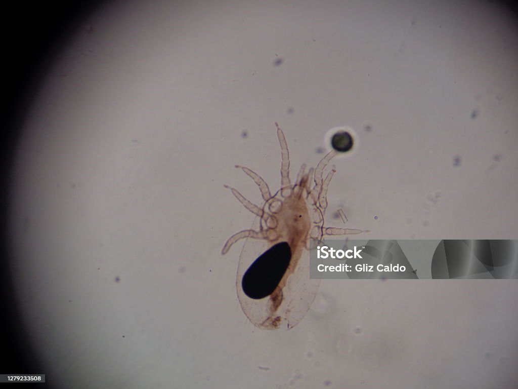 Microscope view of Sarcoptes scabiei Microscope view of an itch mite. Microscope Stock Photo