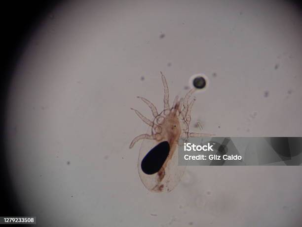 Microscope View Of Sarcoptes Scabiei Stock Photo - Download Image Now - Microscope, Mite, Color Image