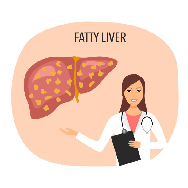 Fatty Liver Disease With Doctor Vector Illustration Human Liver Damage In  Flat Design Healthcare Concept Stock Illustration - Download Image Now -  iStock