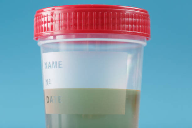 istock A container for biomaterials with a urine analysis and a red lid on a blue background. 1279281451